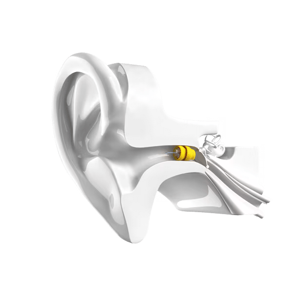 phonak-lyric-ohr-kanal-abonnement